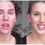 Receita Caseira para Acabar com as Espinhas