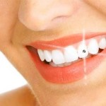 Piercing nos Dentes, Dicas e Fotos